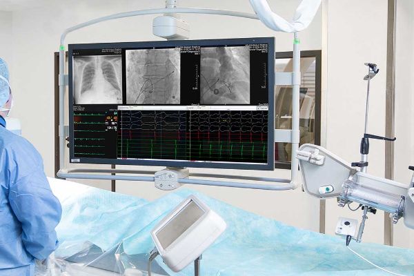 doctor in scrubs looking at x-rays of a persons chest